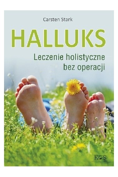 Halluks Leczenie holistyczne bez operacji